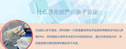内蒙古孕期亲子鉴定如何办理，内蒙古孕期亲子鉴定结果准不准确
